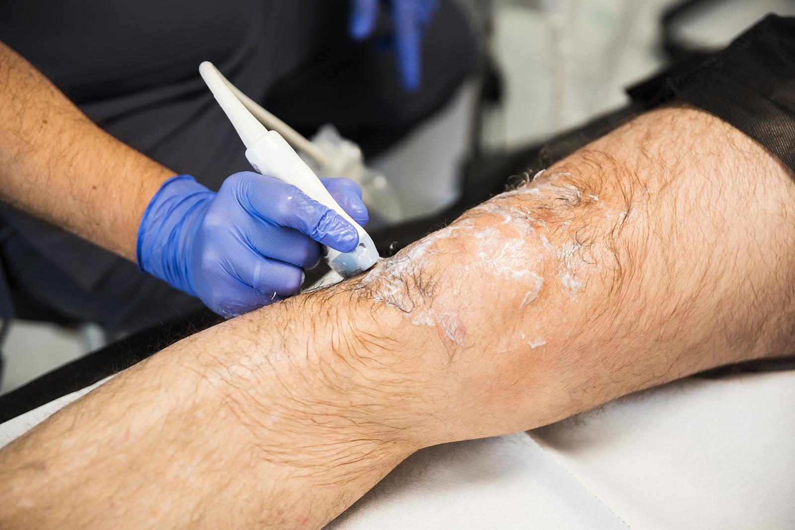 Tratamiento de rehabilitación de rodilla en Labrum